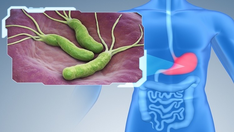   Khói thuốc lá làm tăng nguy cơ nhiễm và tạo điều kiện cho vi khuẩn Helicobacter pylori (H. pylori) phát triển